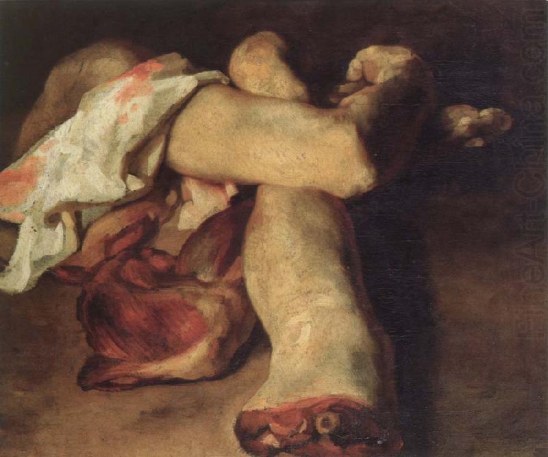 anatomical pieces, Theodore Gericault